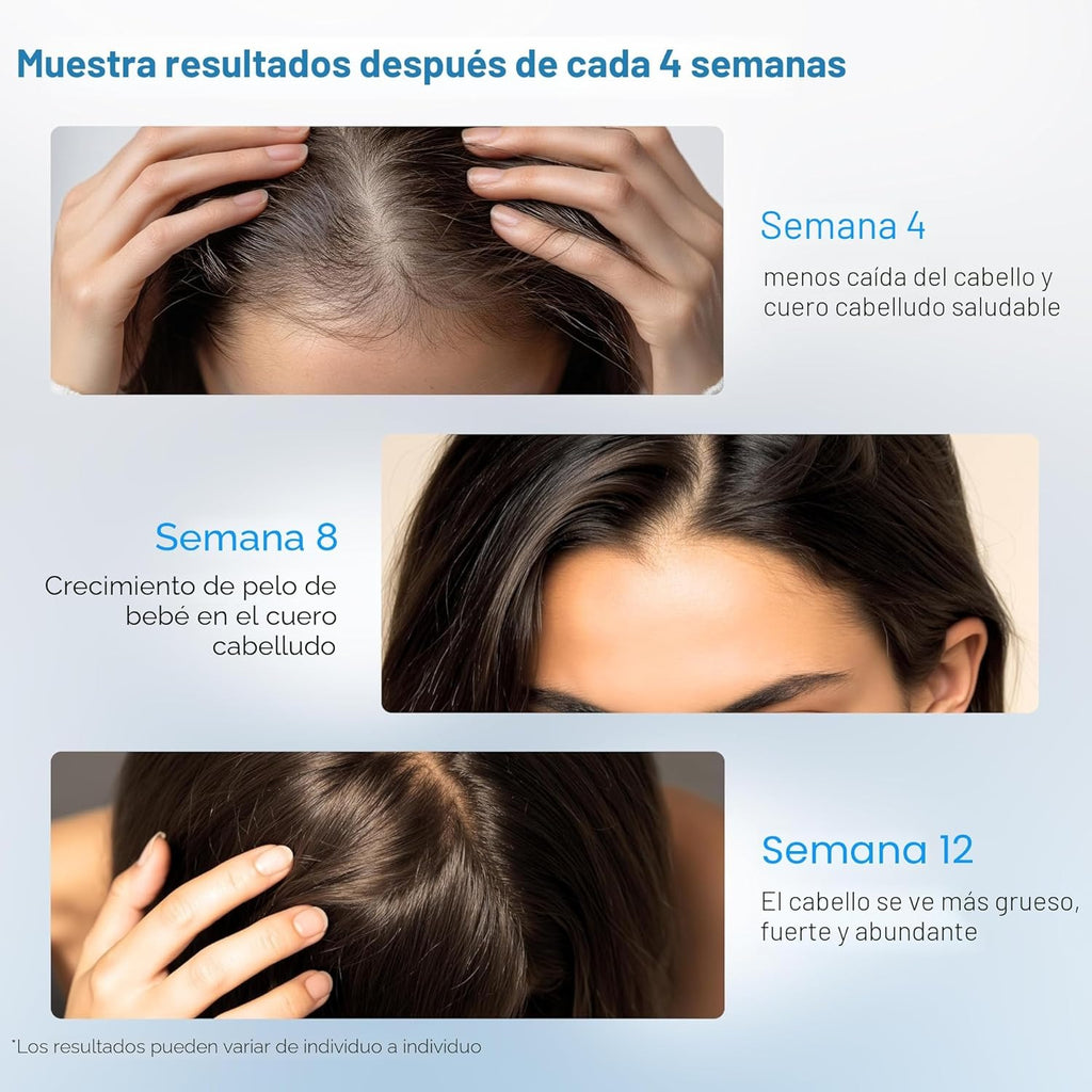 🌿Sérum Capilar Be Bodywise Con Romero - Cuida tu cabello como se merece
